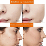 Glow Plus Gold Skin Whitening & Natural Brightening Drink