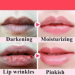 You Bello Lip Lightening Gel for Smokers