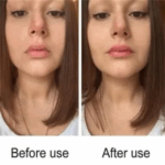 You Bello Lip Lightening Gel for Smokers