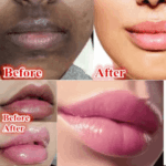 You Bello Lip Lightening Gel for Smokers