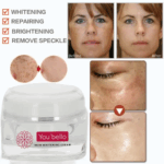 You Bello Skin Whitening Glutathione Cream