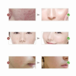 You Bello Skin Whitening Glutathione Cream