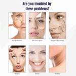You Bello Skin Whitening Night Cream (Imported)