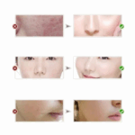 You Bello Skin Whitening Night Cream (Imported)