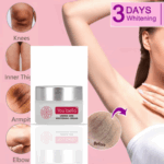 You Bello Under Arm / Armpit Whitening Cream